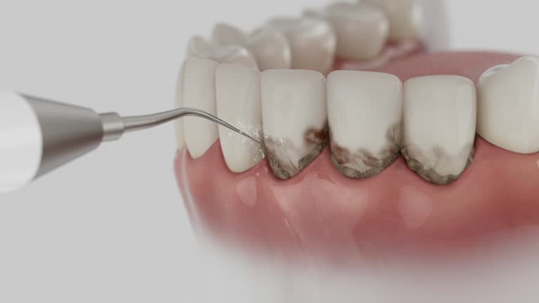 Trusted Emergency Dentist service in Jackson, MO - Dentist Open Now